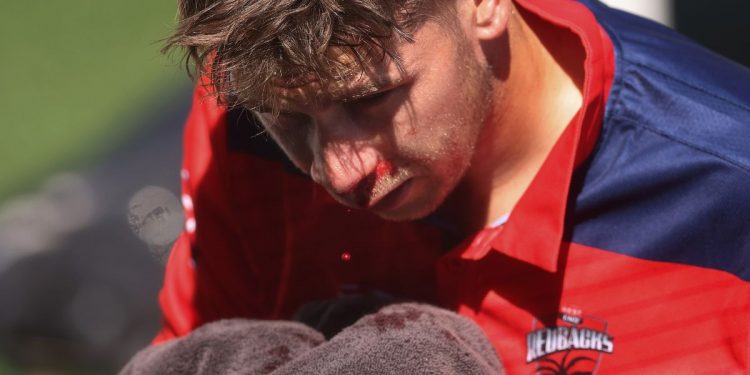 Marsh Cup: Henry Hunt is seriously hurt while playing the field