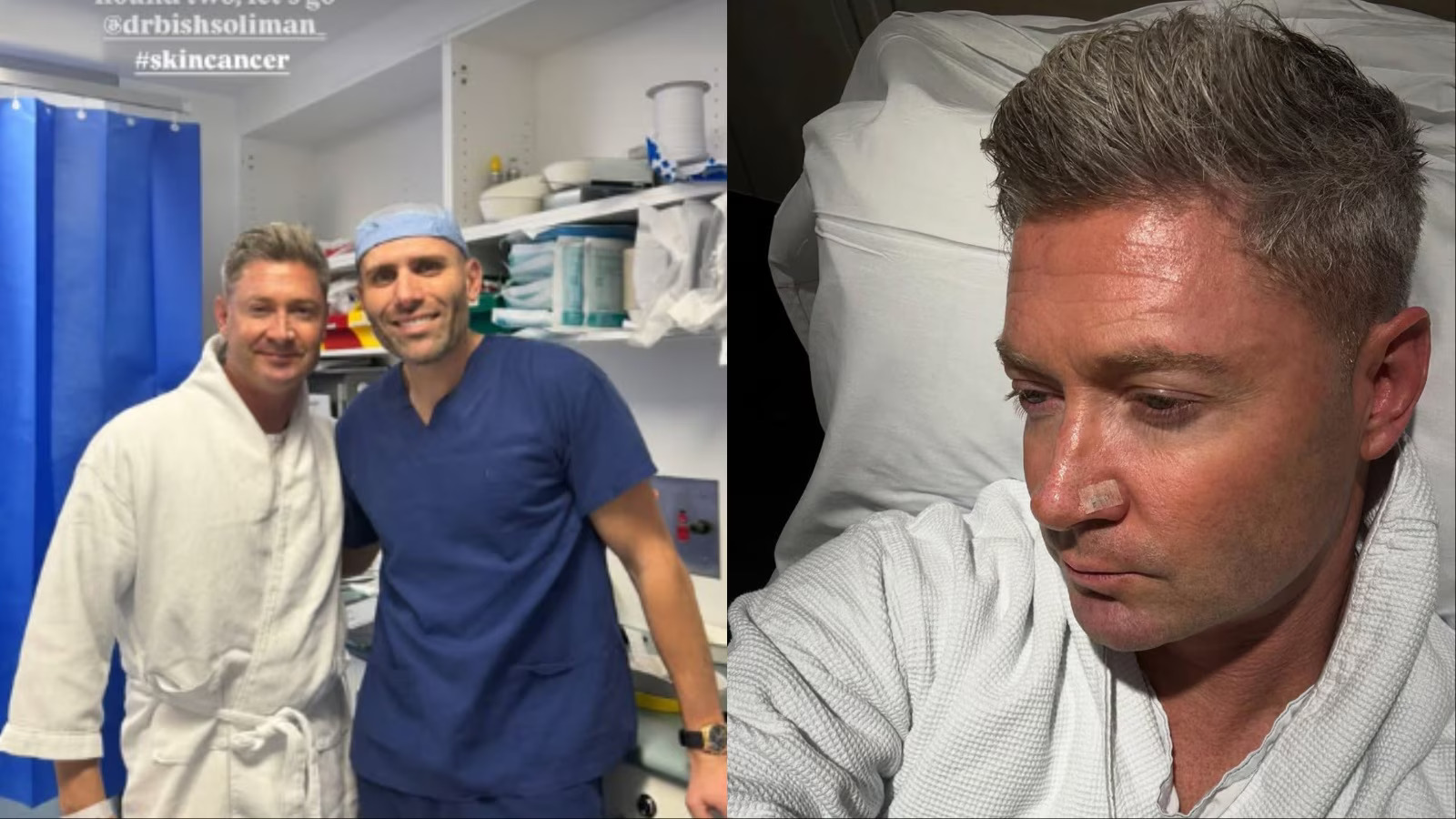 World Cup-winning captain Michael Clarke diagnosed with skin cancer